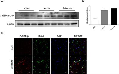 Role of C/EBP-β in Methamphetamine-Mediated Microglial Apoptosis